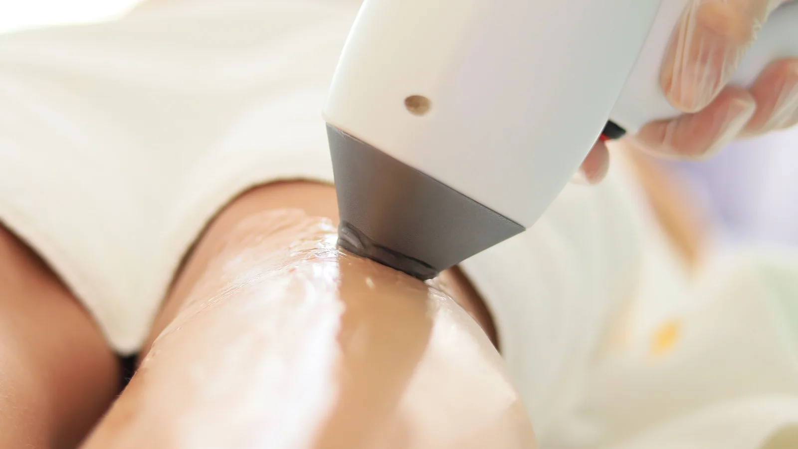 A white hair-removal handpiece held against a person's shin.