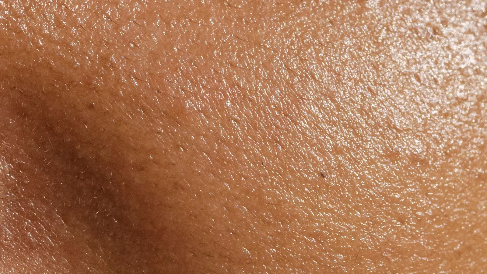Close-up photograph of brown facial skin with visible pores.