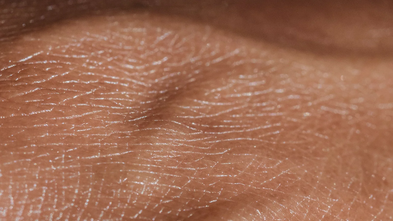 Close-up photograph of natural skin lines and texture.