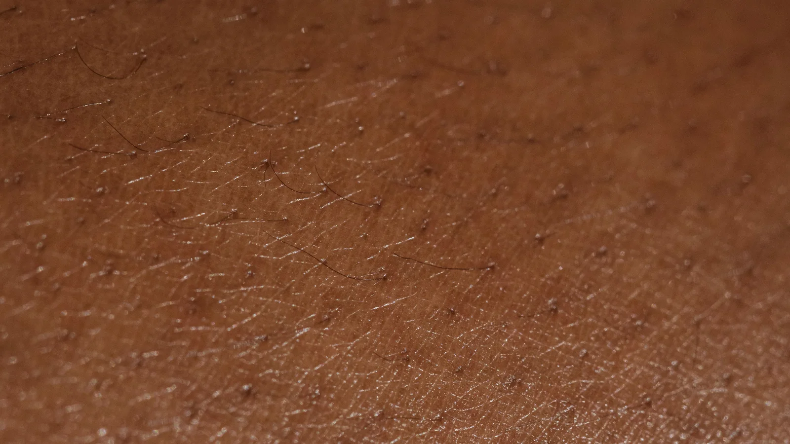 Close-up of natural brown skin with visible fine hairs and texture.
